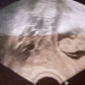 ماساي كاريون profile icon