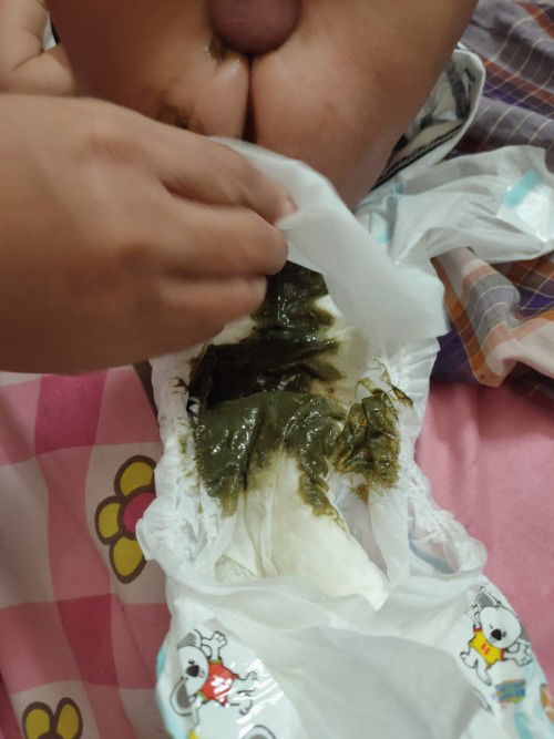 pup bayi hijsu gelap