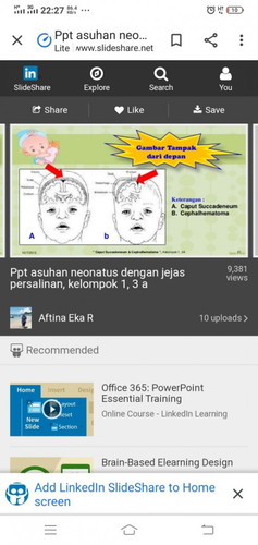 Caput