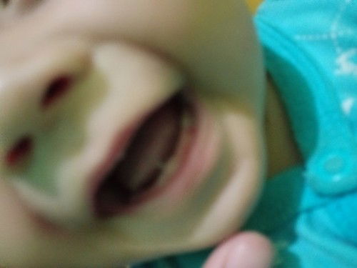 bayi 4 bulan tumbuh gigi