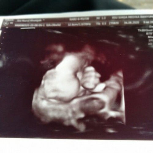 apa bener ini foto mukanya baby bun?