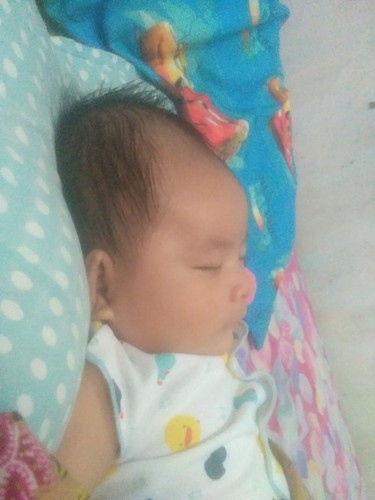 Kepala bayi lonjong