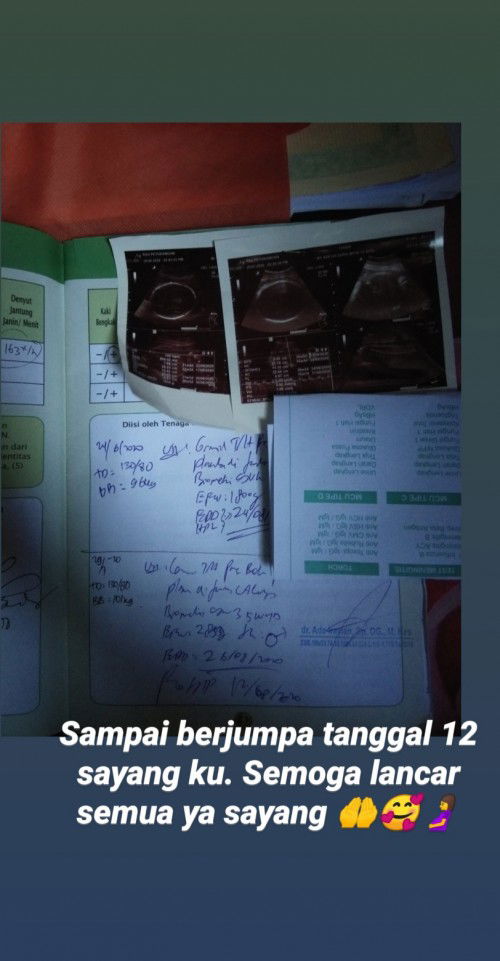 engga terasa 1 minggu lagi jadual sc melahirkan