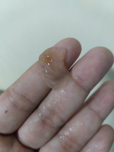 มีมูกสีน้ำตาล