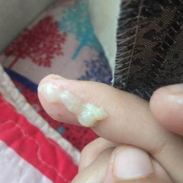 mucus