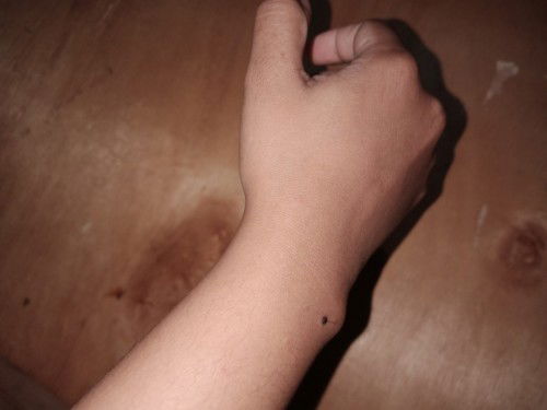 pergelangan tangan sakit