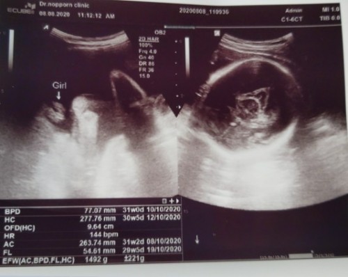 เพศลูก