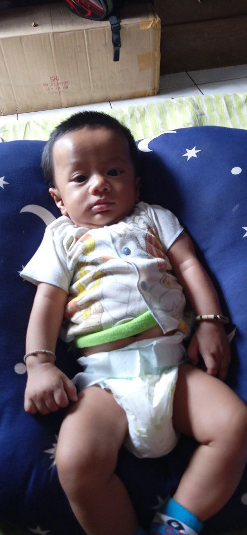 bayi lahir prematur dan minum air ketuban