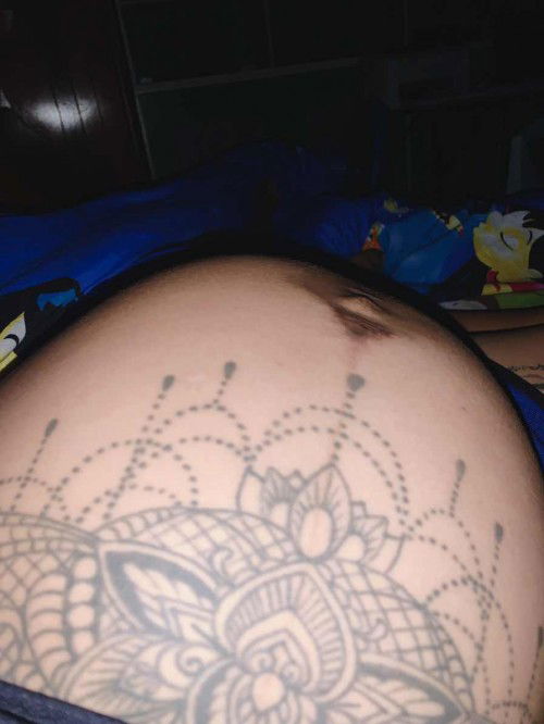 ปวดท้อง 31 week