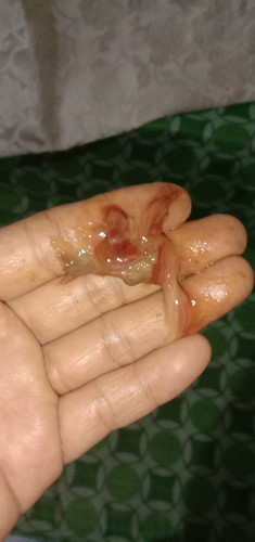 bloody discharged
