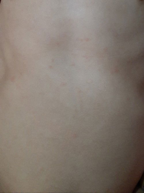 anak suhu naik turun