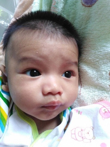 น้องเป็นผื่น