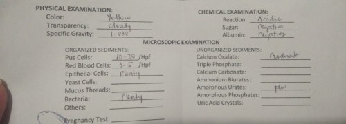 Urine test