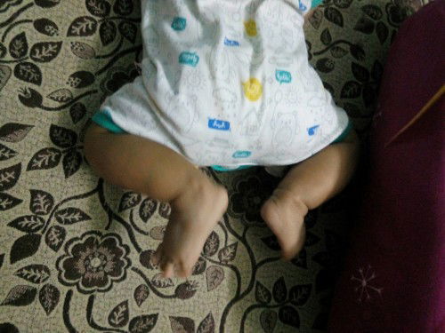 kaki bayi nekuk