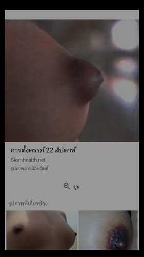 มีใครเป็นไหม