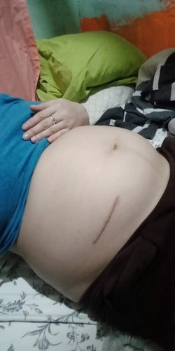 Mahapdi sya 6mons pregnant