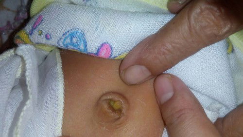 PUSAR BAYI MASIH BASAH