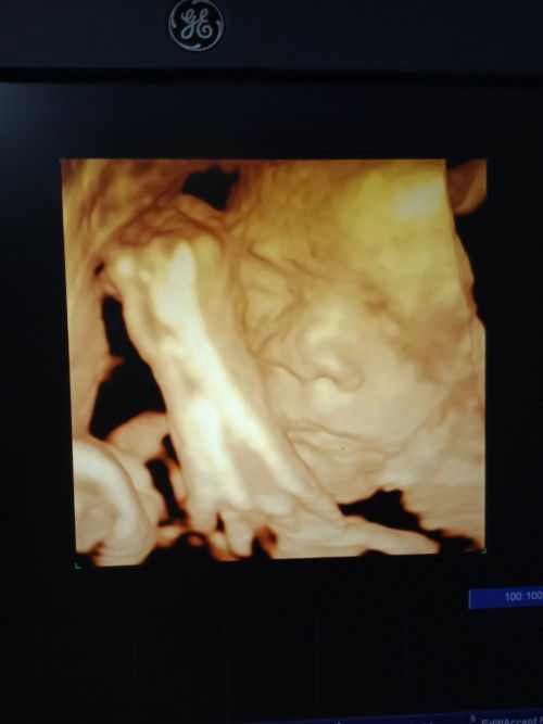 Con là sam 32w nặng 1800g có nhẹ quá ko ạ 🙂