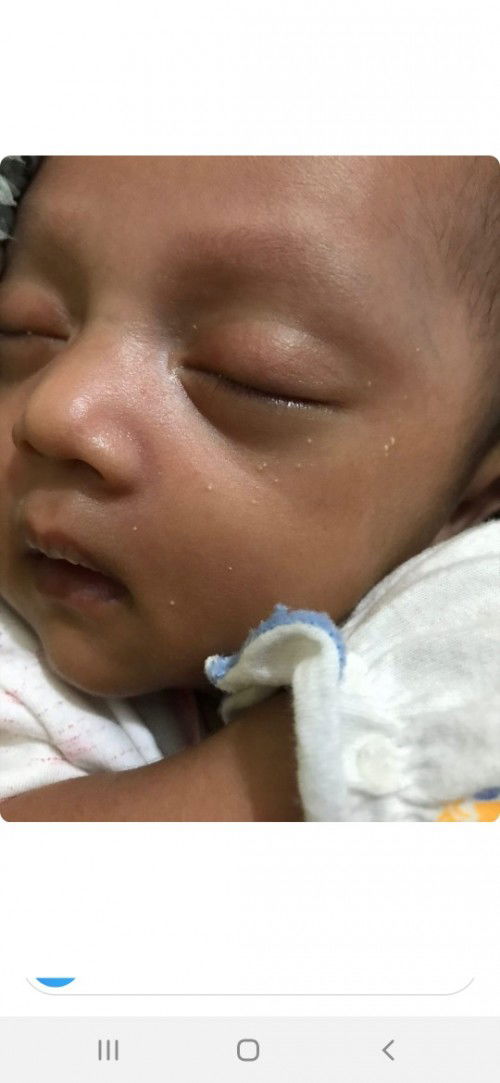 Bintik putih ,kenapa ya??