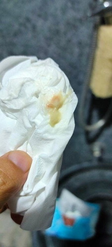 แบบนี้มีอาการแท้งคุกคามมั้ย