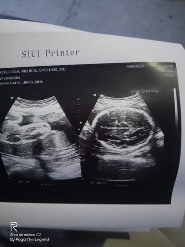 Its a boy!!🥰🥰🥰🥰