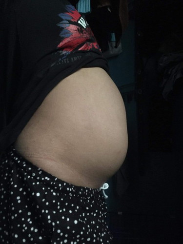 Worried sa size ng tummy