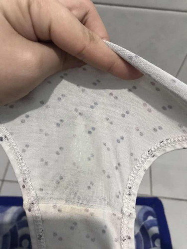 White discharge