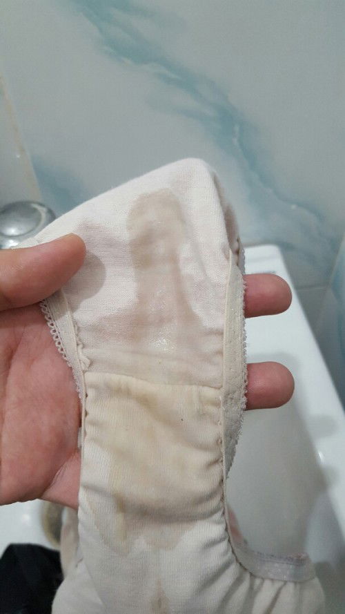 HELP: Water Leak? Or Common Vaginal Discharge?
