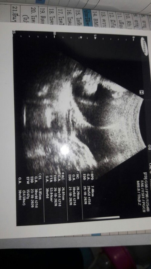 คุณแม่ตั้งครรภ์