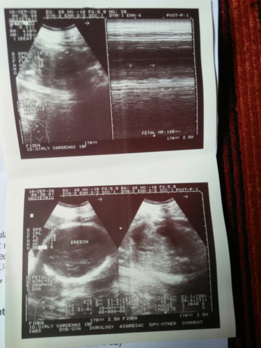 #2ndtimeultrasound