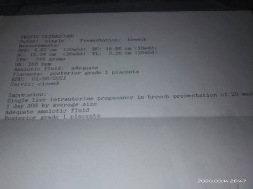Posterior Grade 1 Placenta