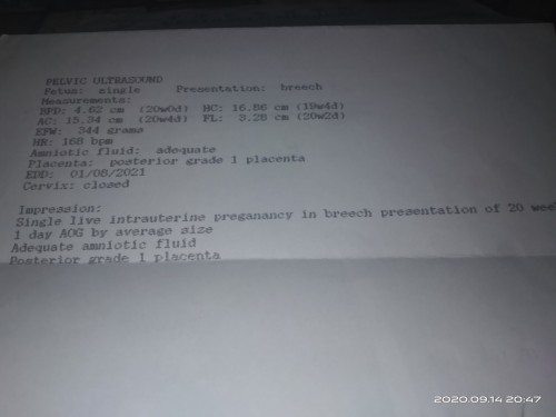 Posterior Grade 1 Placenta