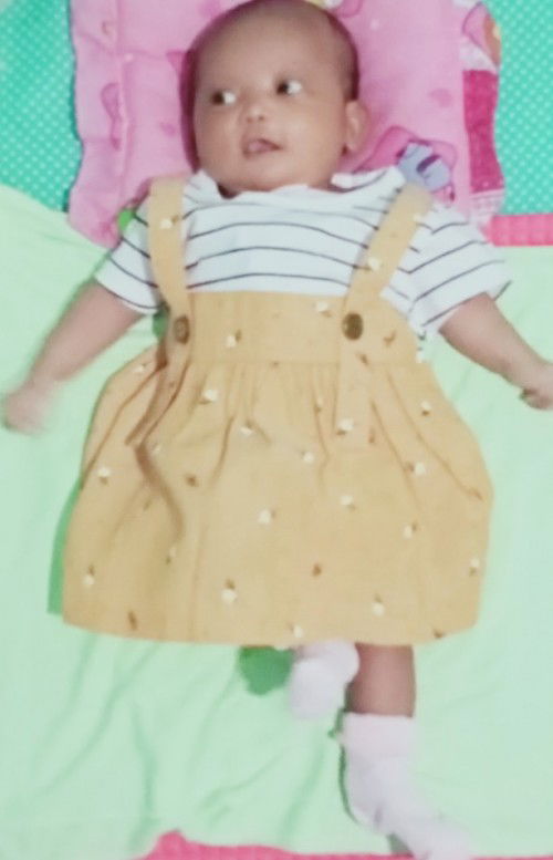 Bayi 1 bulan sering kentut