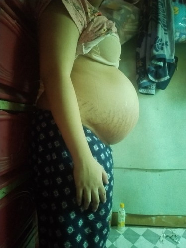 37w2d