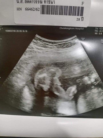 ทีมมกราคม64ค่ะ