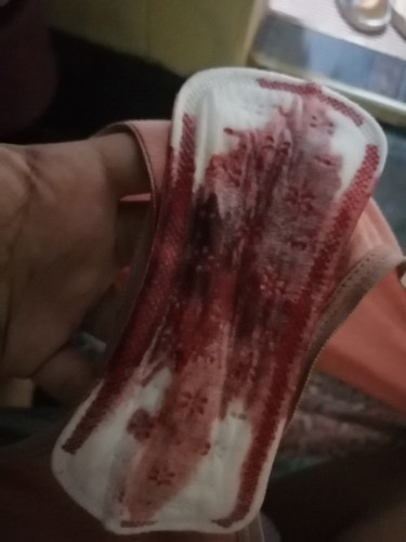 Menstruation or bloody discharged