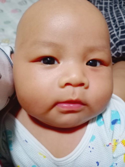 ตอนนี้น้องได้ 2 เดือน 5 วัน 
น้ำหนัก 7 โลแล้วค่ะ😂