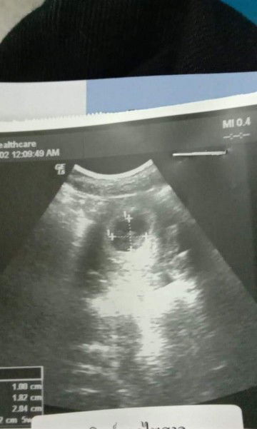 ท้องแรกค่ะ