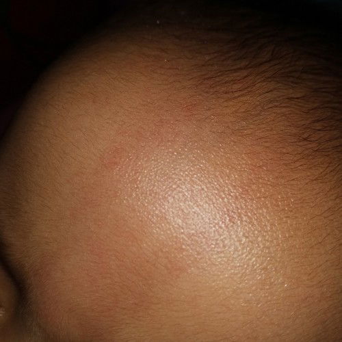 Tanda merah di kening