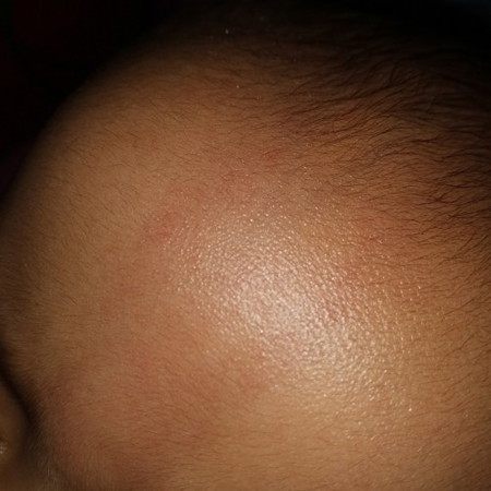 Tanda merah di kening