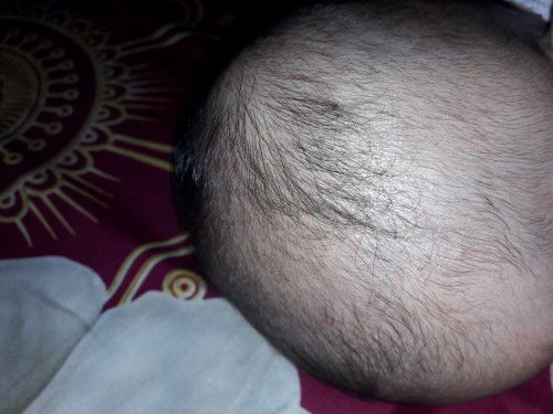 Rambut si kecil lebat dan panjang