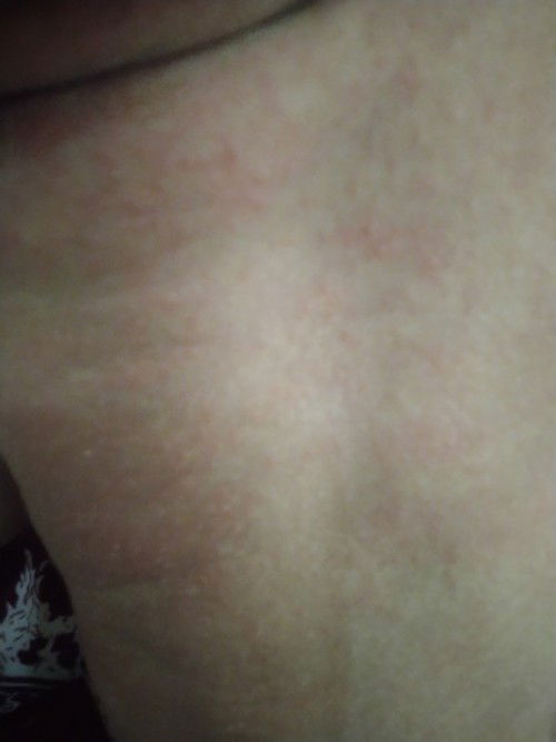 Biang keringat bukan ya ?