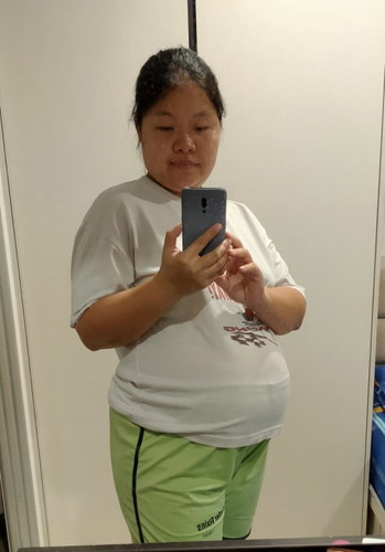 ท้อง 28+5 week เป็นเบาหวานตั้งครรภ์