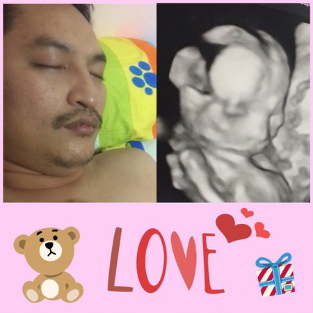 อวดภาพอันตร้าซาว์แม่ๆ 21วีคหน่อยจ้า