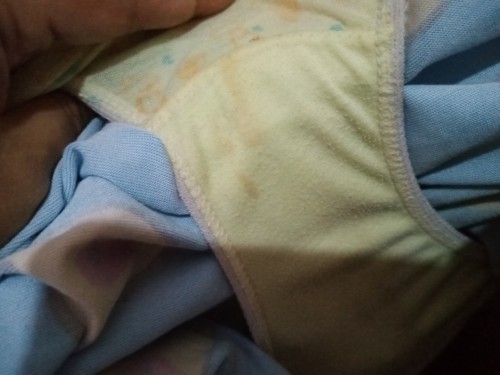 33 weeks may discharge na white mnsan yellow tas nung isang araw may gnyan parang d sya yellow