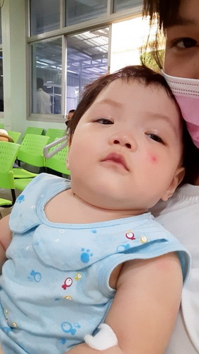 ยุงกัด ทายาอะไรดีคะ แบบที่ดีต่อผิว