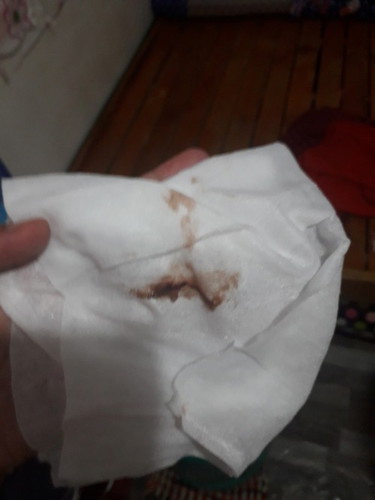 AFTER IE