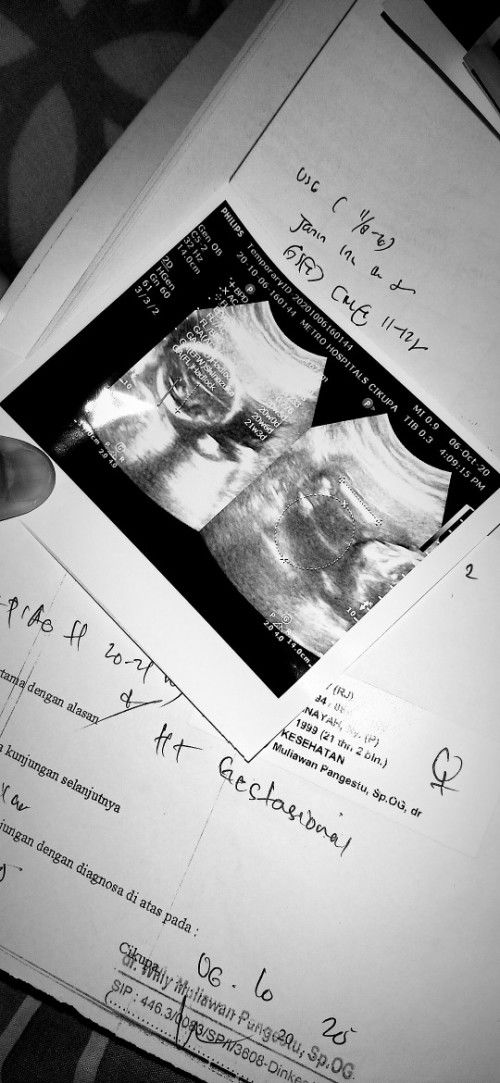 tolong dijwab bunda please