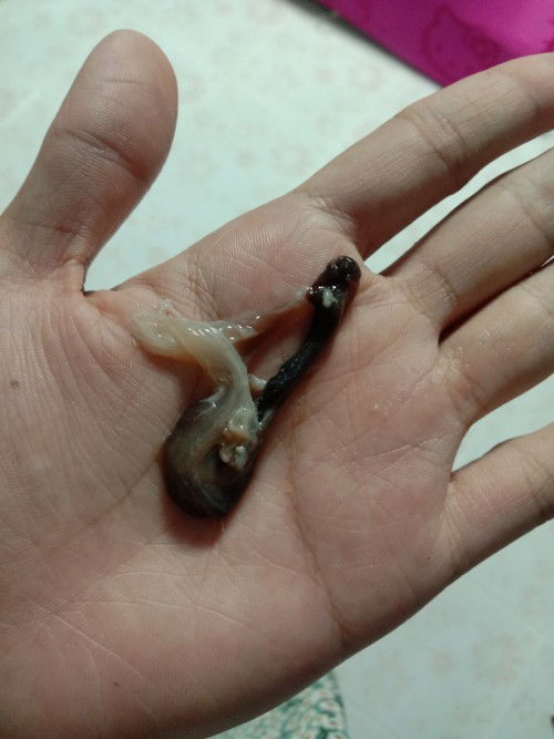 ถามคะ 35+1w