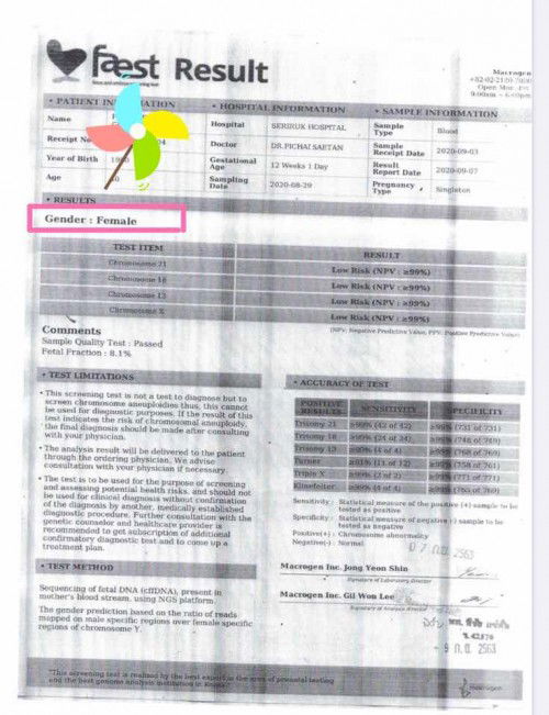 ตรวจคัดกรองดาวน์ซินโดม